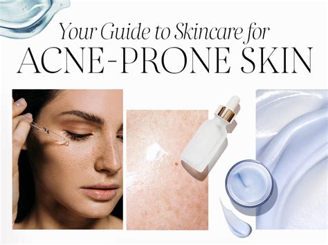 Best Skincare for Acne-Prone Skin | Sephora New Zealand