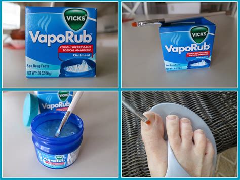 Effective Types of Toe Fungus Treatment