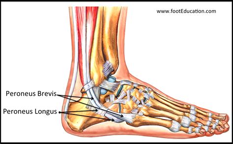 Peroneal Tendonitis - FootEducation