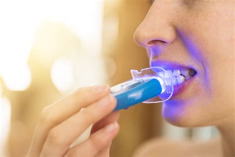 Teeth Treat: Whitening strips for sensitive teeth reviews