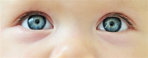 Infant Eye Development - Irishhealth Clinic