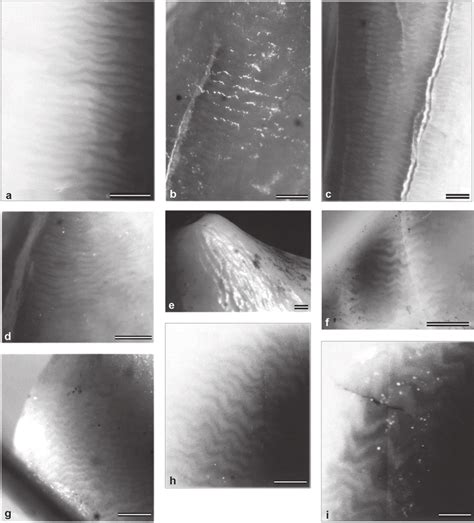 Hunter-Schreger bands (HBS) and outer enamel features in viverrids and... | Download Scientific ...