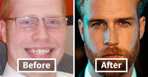 30 Men Who Are Now Rocking A Bearded Look Share How They Looked Before ...