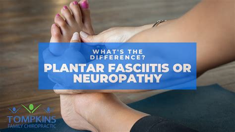 What’s the difference between plantar fasciitis and peripheral neuropathy - YouTube