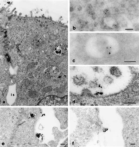 Analysis of transcytosis of LPS by transmission electron microscopy.... | Download Scientific ...