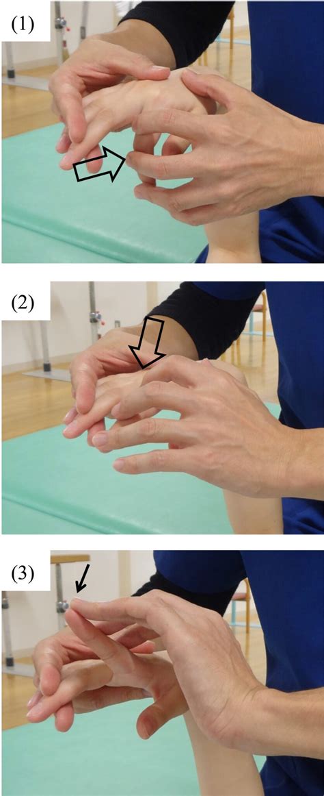 SPASTICITY IN HAND