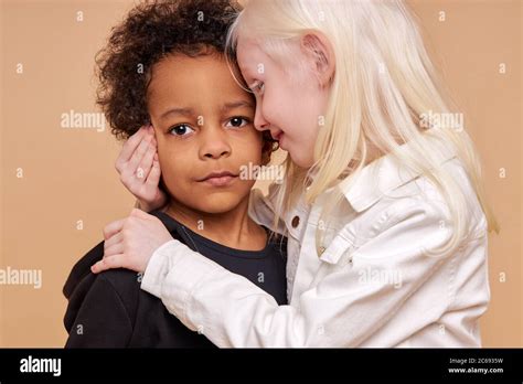 sensitive albino child girl hug african boy isolated in studio ...