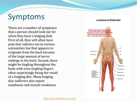 Causes, Symptoms, and Treatment of a Bulging Disc Lower Back Muscle