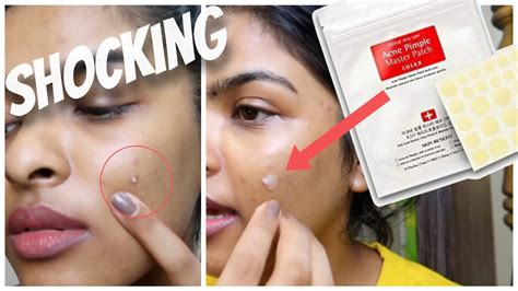 WHAT? Acne Gone in 24 Hours ? Acne Pimple Patch Test | KOREAN Skin Care ROUTINE ft. Yesstyle ...