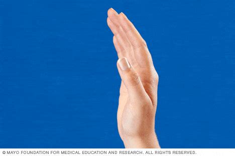Slide show: Hand exercises for people with arthritis - Mayo Clinic Hand Exercises For Arthritis ...