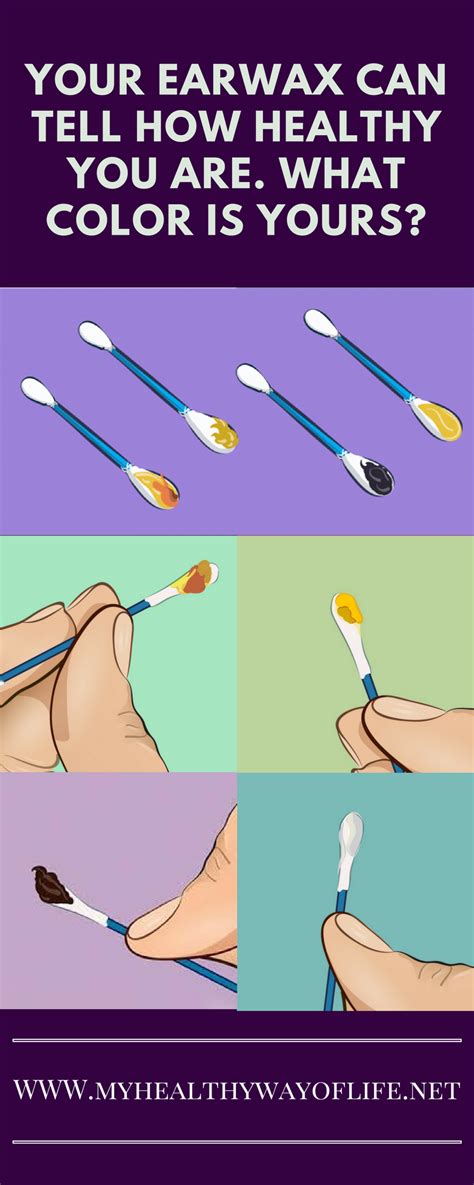 Your Earwax Can Tell How Healthy You Are. What Color Is Yours? | Ear wax, Smiles happy people ...