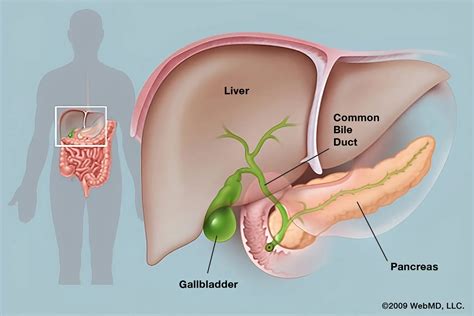 Gall Bladder Pain: Causes, Symptoms, Treatment