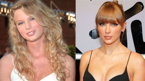 Taylor Swift's Plastic Surgery: Lorry Hill's Analysis of the Singer's Face and Body; Did She ...