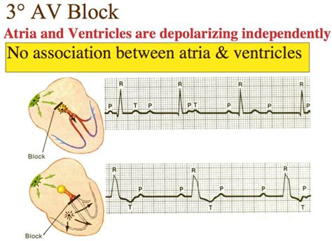 Pin on Educational Medical Diagrams