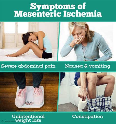 Mesenteric Ischemia - Causes, Symptoms, Diagnosis and Treatment