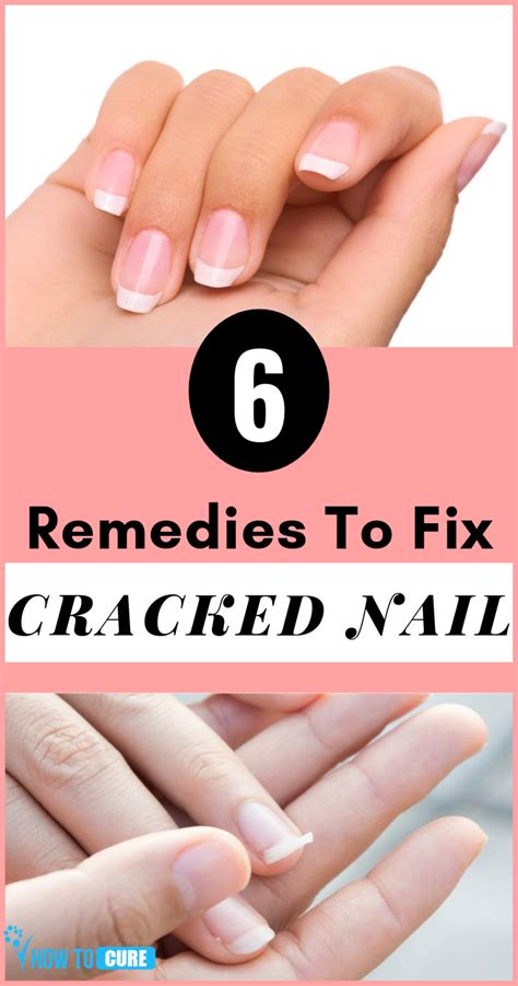 6 Remedies To Fix Cracked Nail - HowToCure | Fix cracked nail, Cracked ...