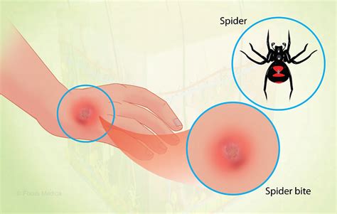 Health Condition : Symptoms, Causes, Treatment and More