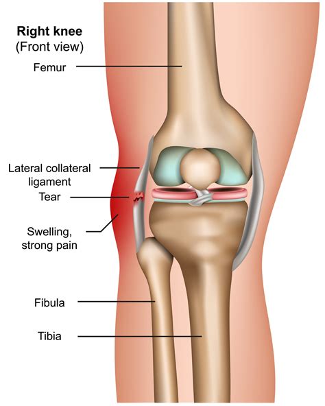 Lateral Collateral Ligament — Adam B. Cohen, MD