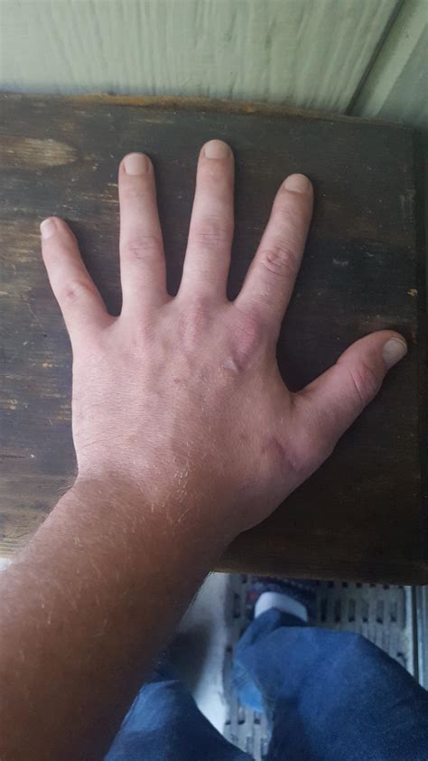 Like scars? : r/hands