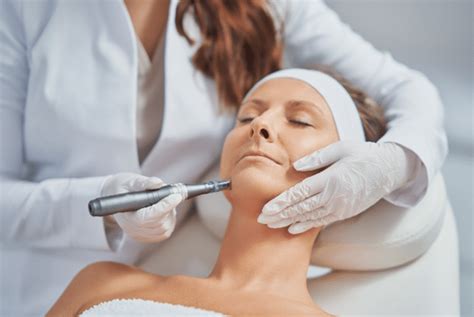 Microneedling Benefits: A Journey to Beautiful Skin - Urban Body Laser, Vancouver, BC