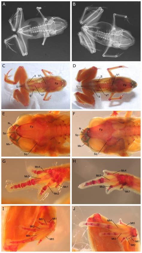 A. X-ray of paratype of Paedophryne amauensis (LSUMZ 95002). B. X-ray ...