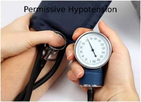 Permissive Hypotension : Dr Awaneesh Katiyar