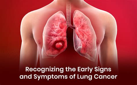 Recognizing the Early Signs and Symptoms of Lung Cancer