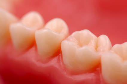 Gum Disease: Causes, Symptoms, and Treatments in Washington - Washington Center for Cosmetic ...