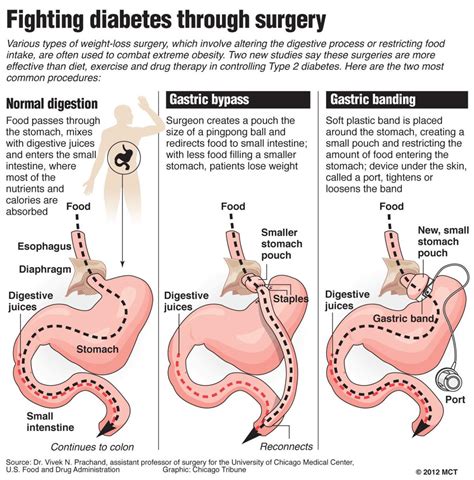 Billings Clinic accreditation opens up weight loss surgery to more patients | Health and Fitness ...