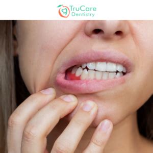 What Is Gum Boil? Explore Causes, Symptoms, and Treatment | Dentist in Roswell, GA | TruCare ...