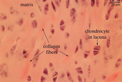 Fibrocartilage Histology Labeled