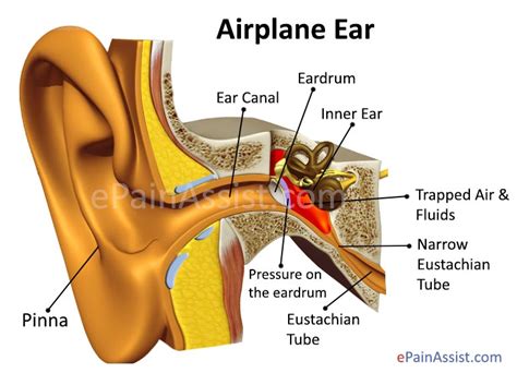 10 Simple Remedies For Earache - Youth Village Kenya