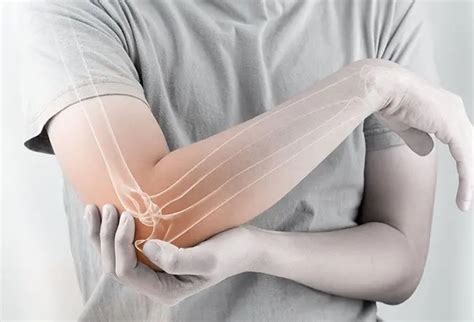 How Long Does a Fractured Elbow Take to Heal? Surgery & Recovery