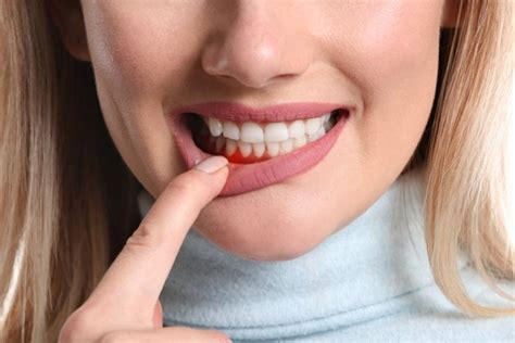 Why Is There A Bump On My Gums? | Worcester Endodontics