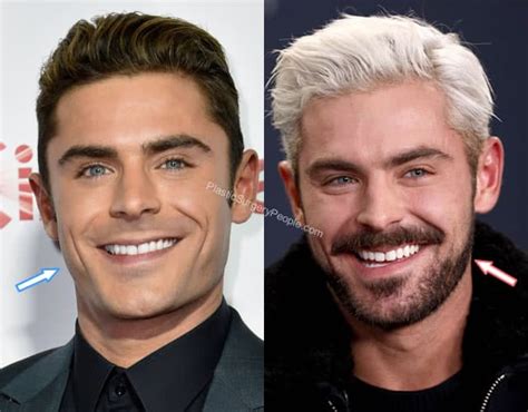 Zac Efron, Before and After 2020