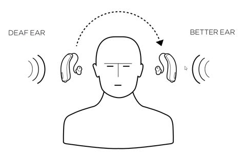 Widex CROS & BiCROS Hearing Aids | HearSource