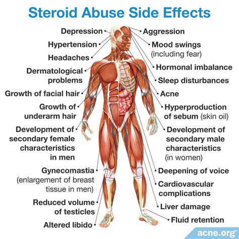 Do Anabolic Steroids Cause Acne? - Acne.org