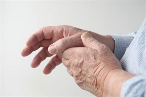 Thumb Arthroplasty | Thumb CMC Surgery | Proliance Puget Sound Orthopedics