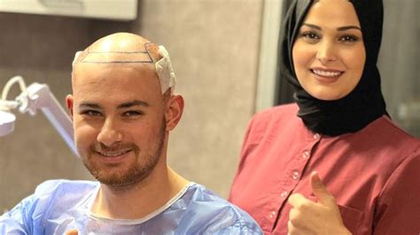 How to Find the Best Hair Transplant Surgeon?