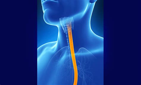 Esophageal Manometry :: Digestive Disease Consultants :: Pontiac, MI