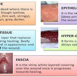 Chronic wound treatment modalities | Download Scientific Diagram