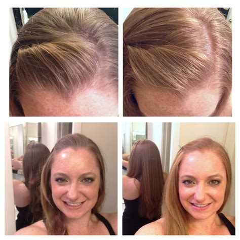 Before and after Clairol Natural Instincts #4 Sunflower Medium Golden Blonde | Blonde hair color ...