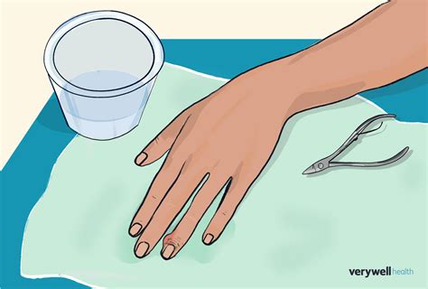 Infected Hangnail: Causes, What to Do, and When to Seek Help