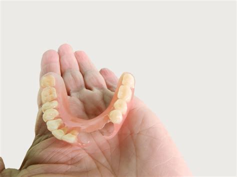 When dentists should use flexible partial dentures - Dandy