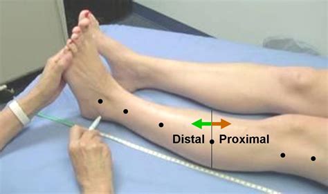 Proximal E Distal Anatomia