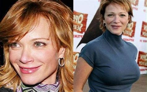 Lauren Holly Plastic Surgery before after