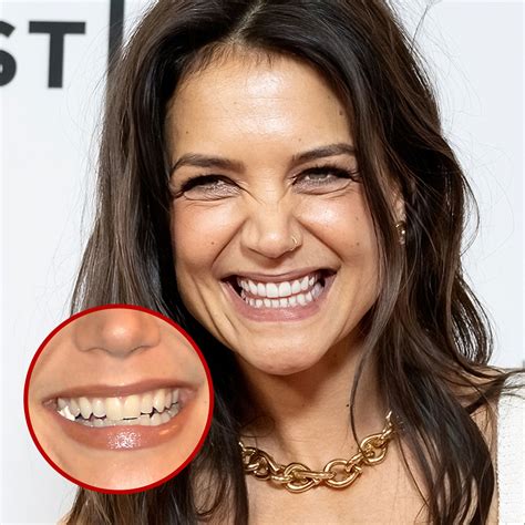 hollywood stars and veneers ( before and after ) - Social Social Social | Social Social Social