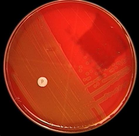 Bacitracin & Optochin Susceptibility test (A & P disks) Flashcards ...