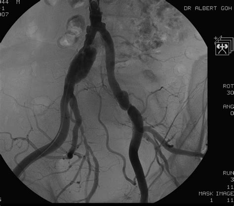 Angiogram – Sydney Medical Interventions