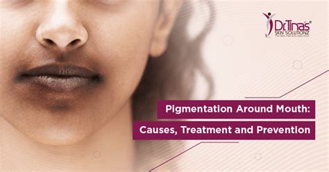 Pigmentation Around Mouth: Causes, Treatment and Prevention - Skin Solutionz